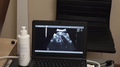 Legrand Wolf uses ultrasound to show how his cock penetrates Austin Lock